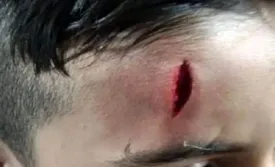 تصویر دانش آموزی که بدجور از معلم خود کتک خورد