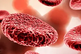 مهم‌ترین نشانه‌های کم خونی چیست و چه باید کرد؟