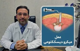 عمل میکروسکوپی دیسک کمر چیست؟ توضیحات دکتر شاه محمدی (متخصص دیسک کمر)