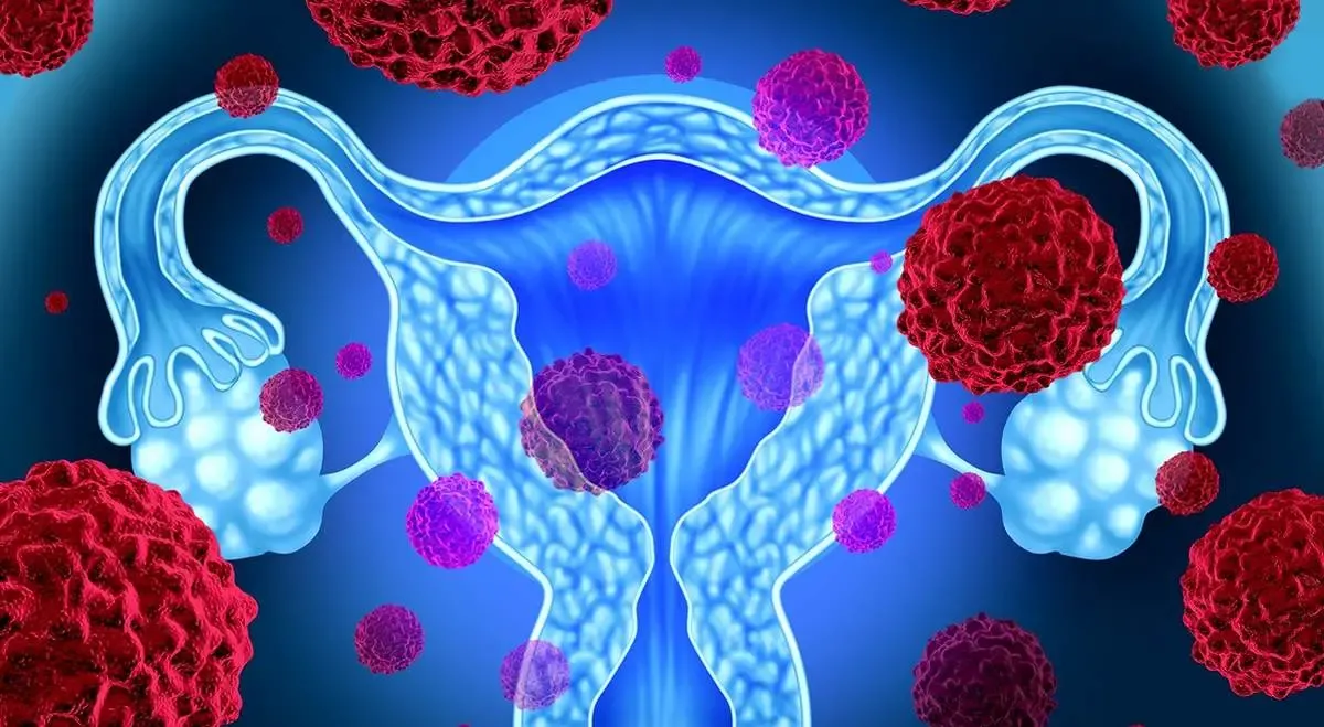 این بیماری باعث نازایی زنان می‌شود