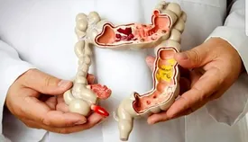 چند نکته خوب در مورد سرطان معده