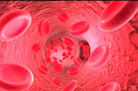 نوشیدنی پرمصرفی که باعث لخته شدن خون می‌شود