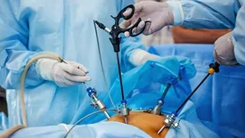 اسلیو یا بایپس؛ کدام روش لاغری بهتر است؟