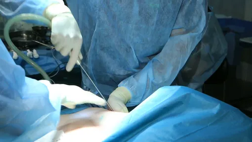 مرگ هولناک زن جوان بعد از عمل پیکرتراشی