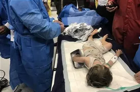 چرخ گوشت دست کودک ۲ ساله را بلعید / عکس