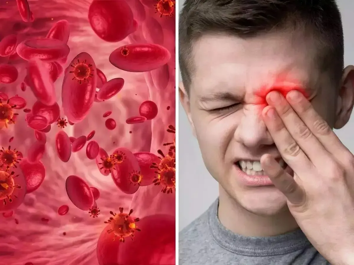 درمان کم خونی با شکلات تلخ و ۹ خوراکی دیگر