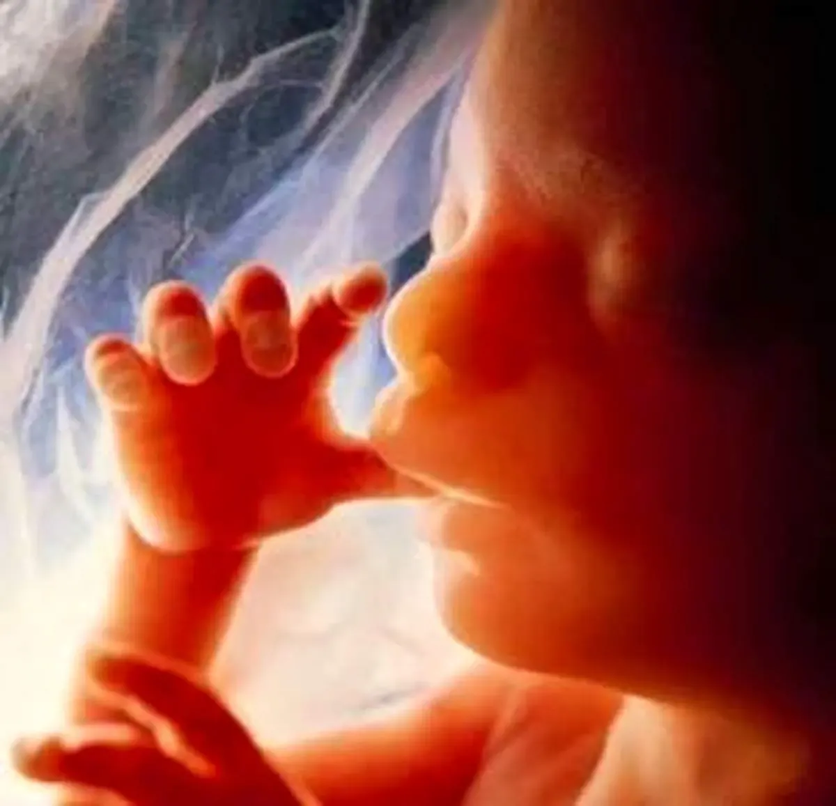 افزایش مرده‌زایی به‌دلیل آلودگی هوا!