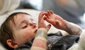 بیماران پروانه ای صاحب خانه می شوند