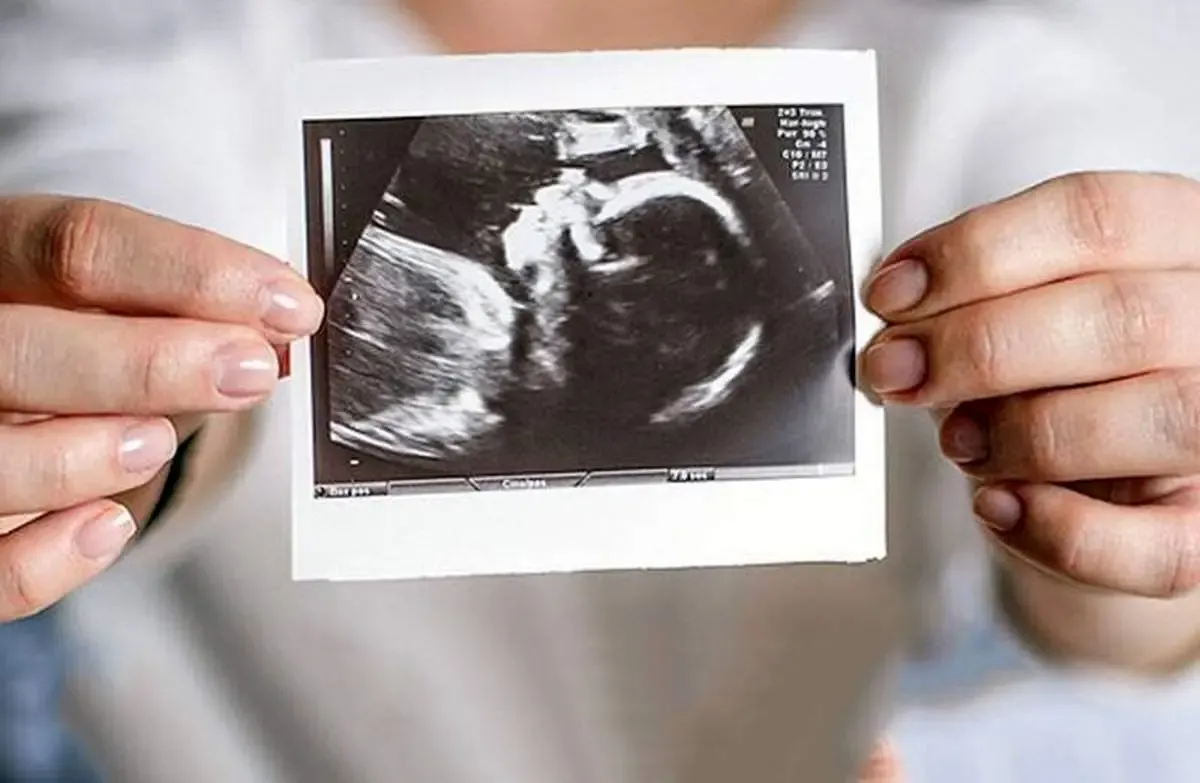 روشهایی نوین از طب سنتی برای افزایش باروری زوجین