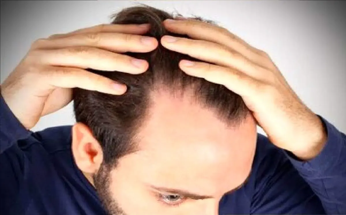 معجزه باورنکردنی این روغن مو در رشد موها