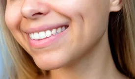 چال گونه بدون جراحی/ جذابیت طبیعی با روشهای ساده خانگی
