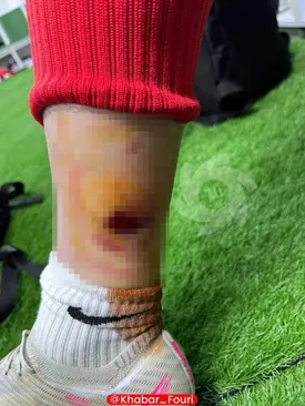 پرتاب نارنجک در بازى پرسپولیس مجروح داد/ عکس