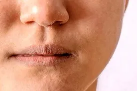 این گروه در سنین پایین پیر می‌شوند