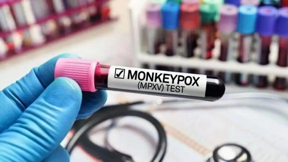 نخستین مرگ ناشی از ام پاکس در تایلند ثبت شد