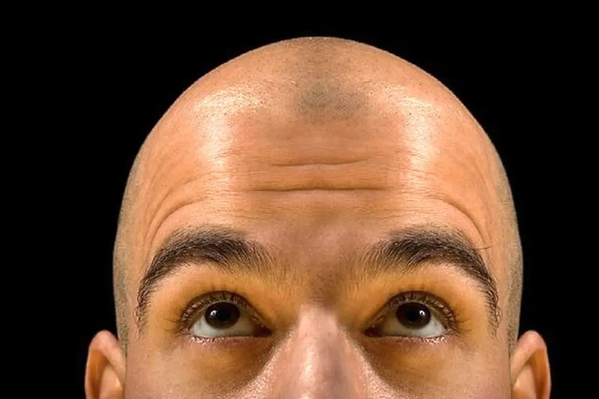 کدام کشورها بیشترین مردان طاس را دارند؟