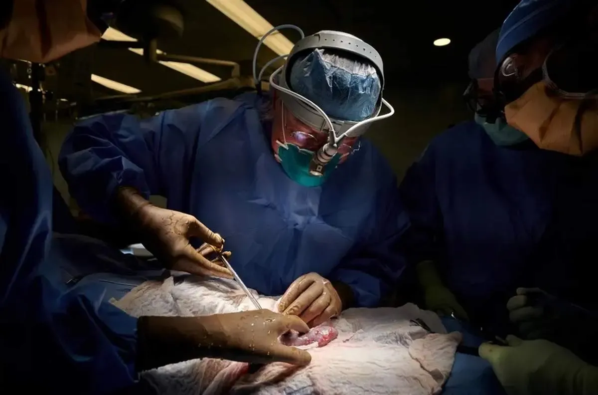 موفقیت آمیز بودن پیوند کلیه خوک به انسان