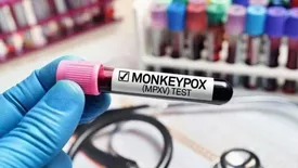 نخستین مرگ ناشی از ام پاکس در تایلند ثبت شد