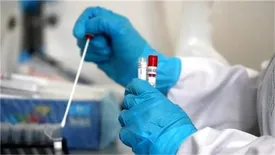 هشدار درباره فروش تست منفی کرونا