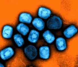 هشدار درباره شیوع انسانی آبله میمون