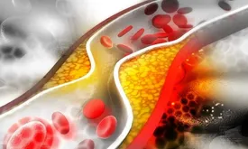 این علائم روی پوست یعنی کلسترولتان بالاست!