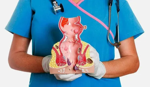 داروهای موقتی و درمان فوری بواسیر/ این غذاها بواسیر را تشدید می‌کنند