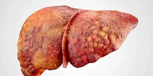 راز تخم‌مرغ و کبد سالم/ پاسخ شگفت‌انگیز متخصصان!