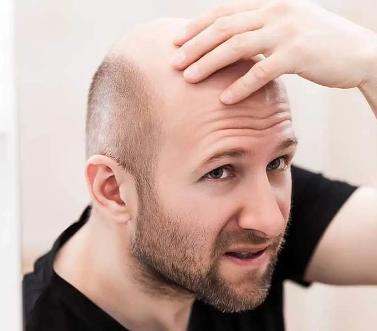 این مشکل روحی شما را کچل می کند