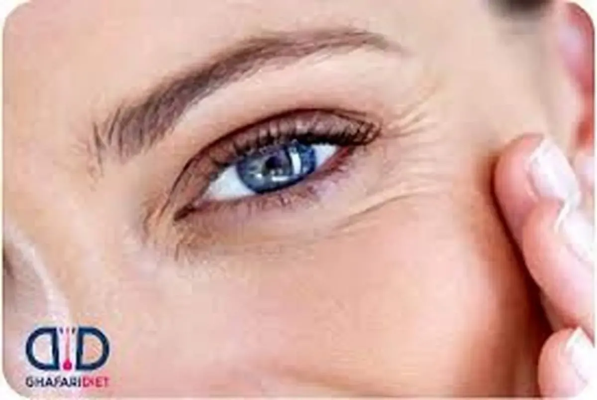این میوه سبب افزایش بینایی می‌شود