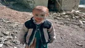 تلفات فاجعه بار زلزله افغانستان/  تاکنون ۲۰۵۳ نفر  مرده اند!/
کسی به فکر مردم افغانستان هست؟!