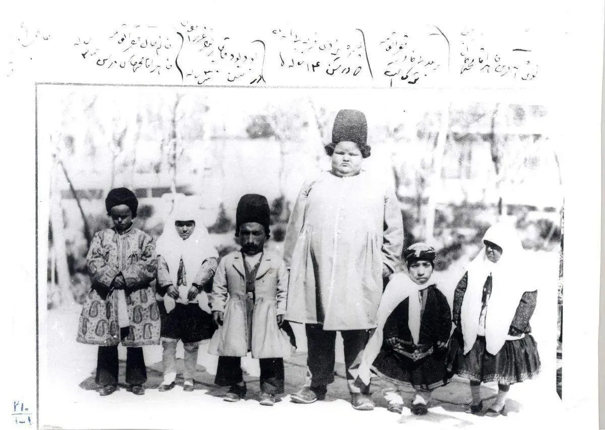 این تدبیر ایرانی‌ها را از کم کاری تیروئید نجات داد