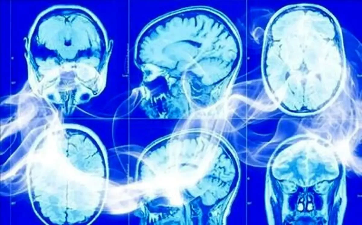 شیوع یک بیماری تنفسی در کشور همسایه ایران