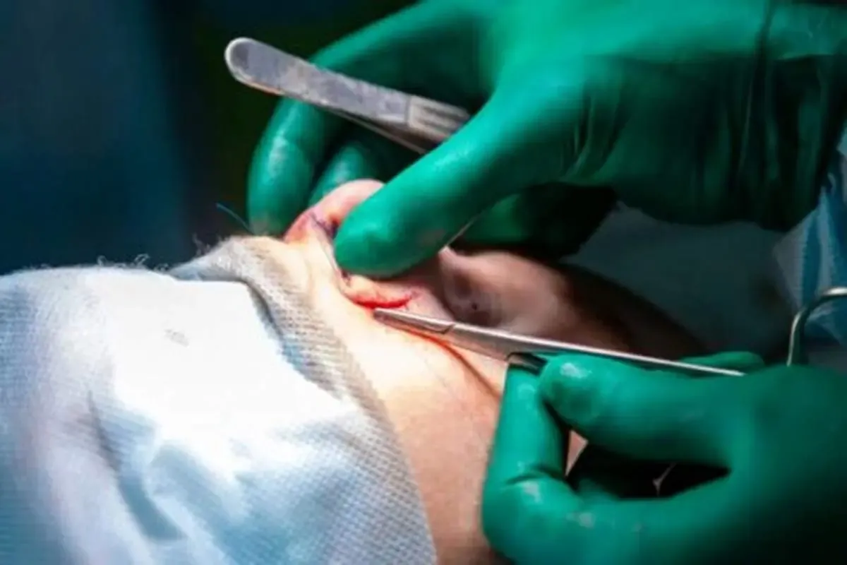 جراحی زیبایی در ایران به نوجوانان رسید!