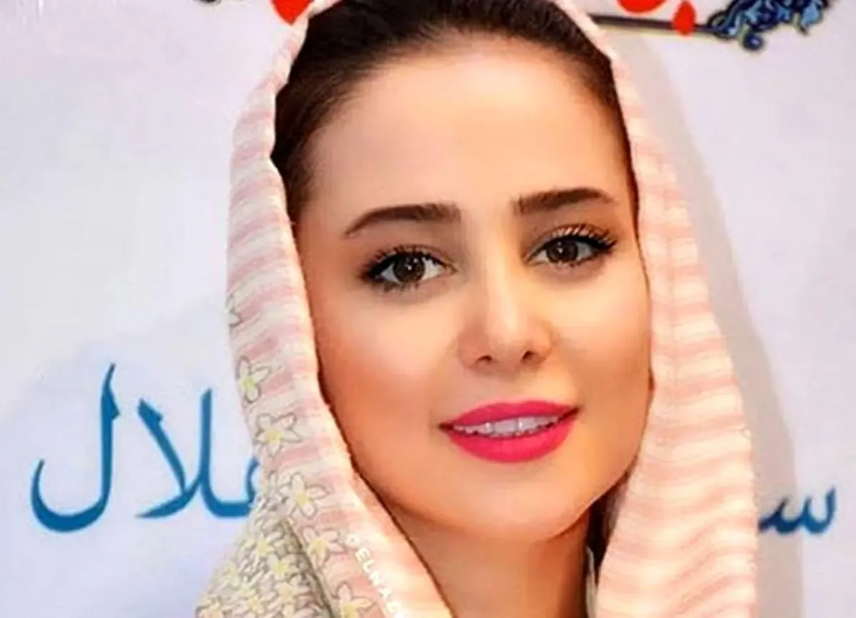عکس دیده‌نشده الناز حبیبی قبل از جراحی‌های زیبایی!