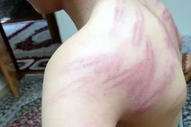 تنبیه بدنی وحشیانه دانش آموز توسط معلم سنندجی