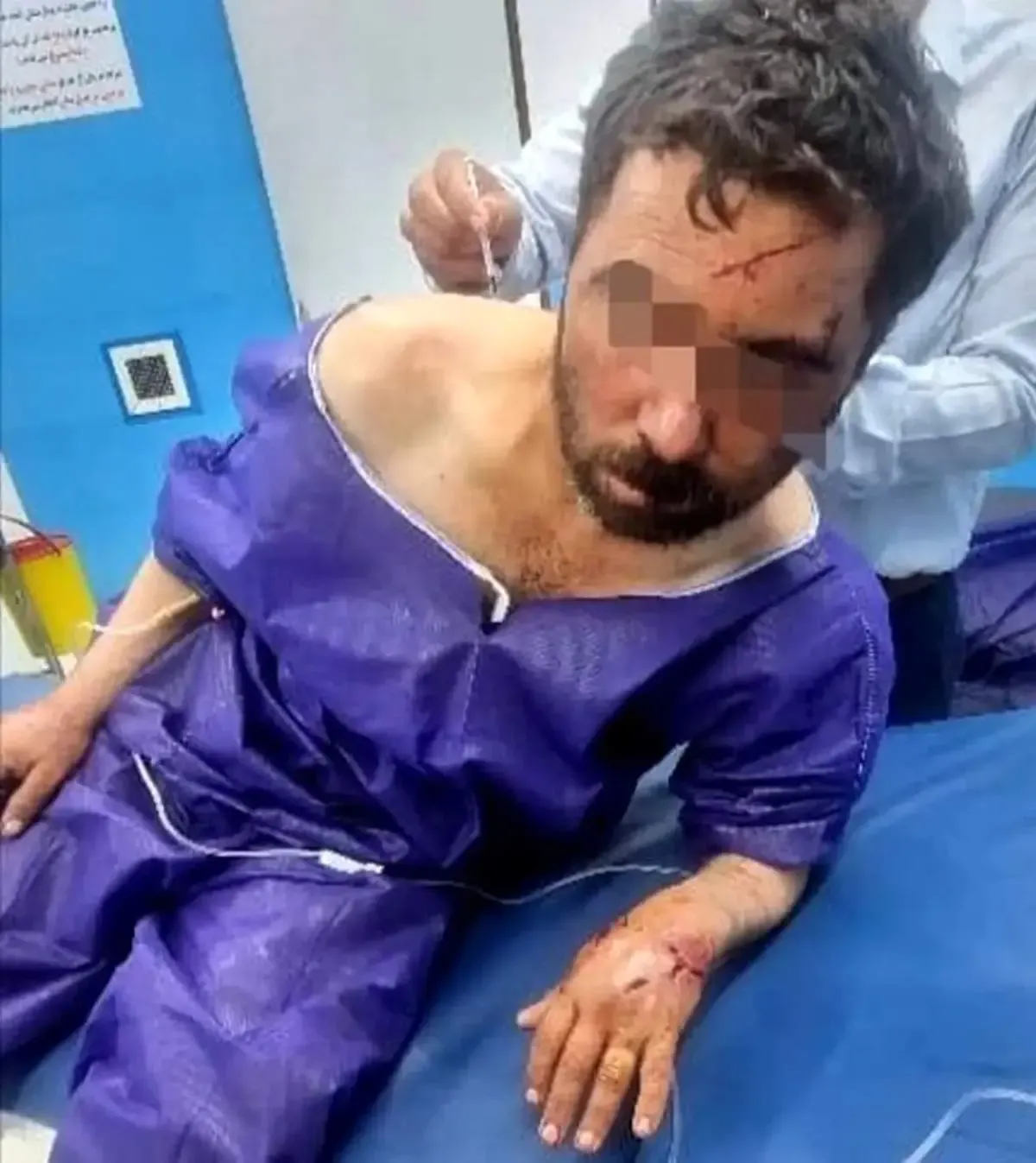 مجروح شدن دامدار جیرفتی بر اثر حمله خرس