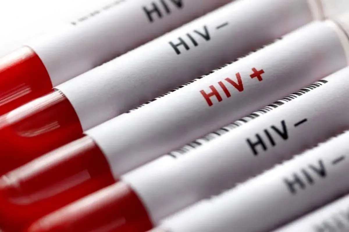 افسردگی شایع‌ترین اختلال روانپزشکی در بیماران مبتلا به HIV