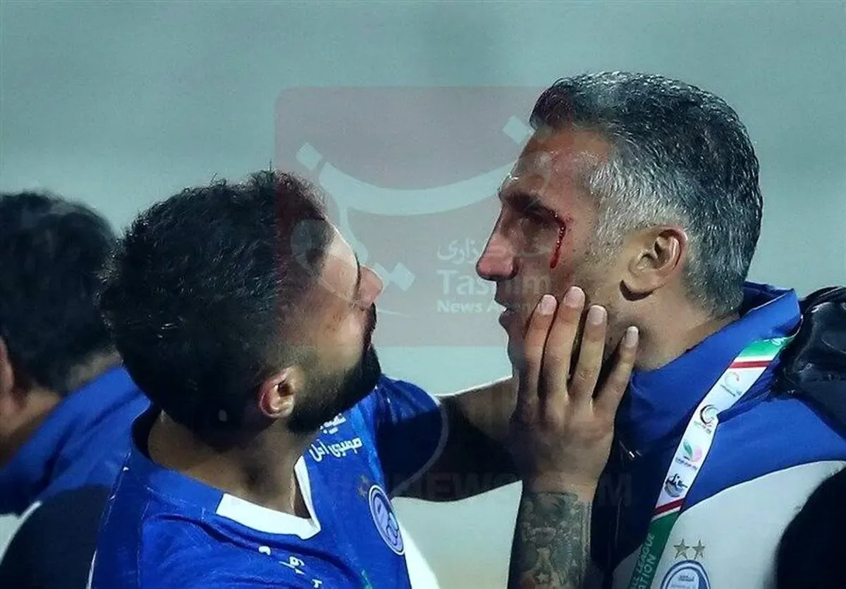 مهدی هاشمی‌نسب با سر و کله خونی بعد از دربی!/ فیلم