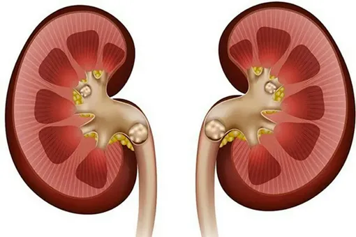 عادات مضر برای کلیه‌ها