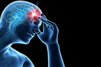علائم مهم سکته مغزی
