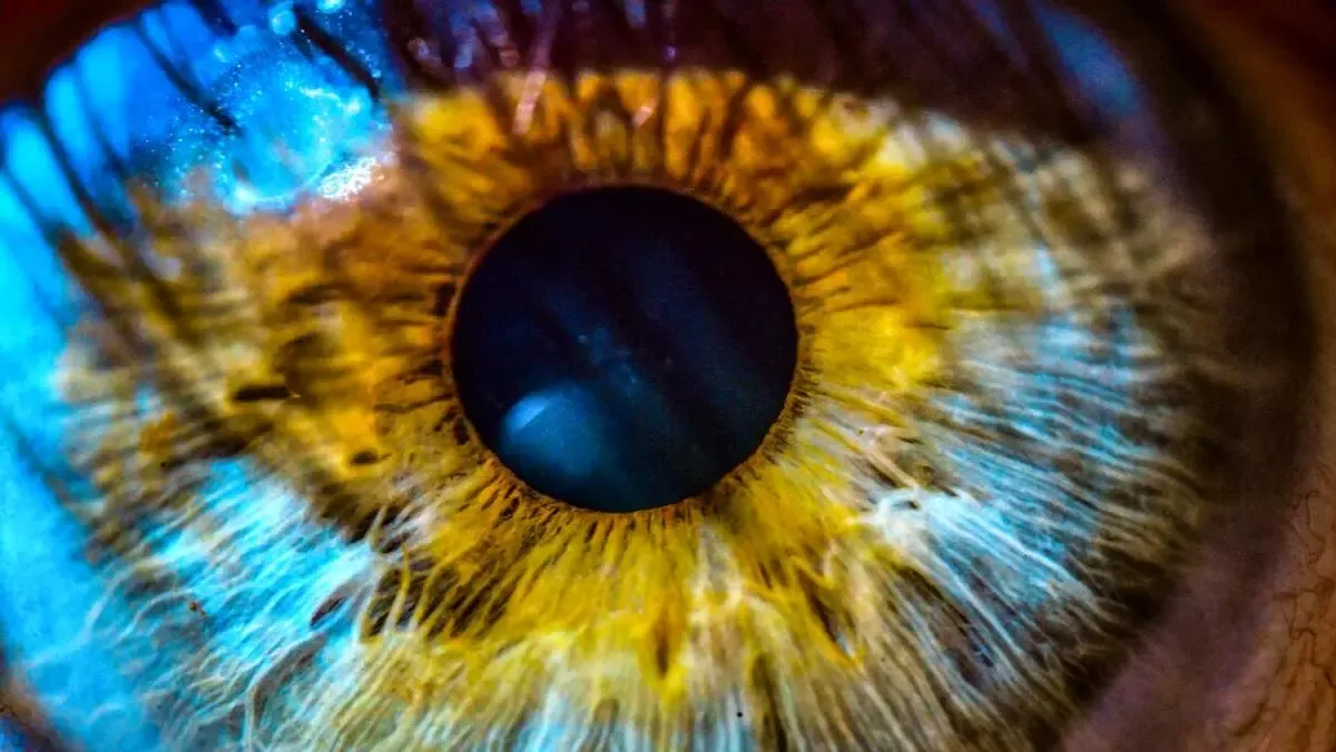 اصلاح بینایی بدون برش قرنیه ممکن شد