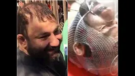 فیلم و عکس از هانی کُرده پس از تیر و چاقو خوردن در بهشت زهرا