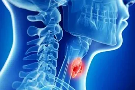 زنان بیشتر از مردان به این سرطان مبتلا می‌شوند