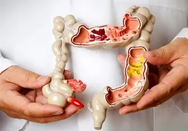 علل بروز یبوست و راه‌های پیشگیری و درمان آن