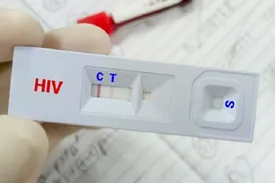 کاهش سهم «اعتیاد» در انتقال HIV