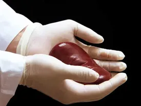 درمان گیاهی سنگ کلیه