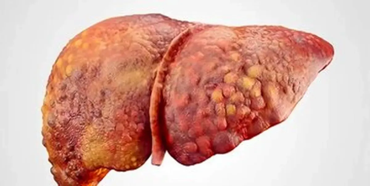 راز تخم‌مرغ و کبد سالم/ پاسخ شگفت‌انگیز متخصصان!