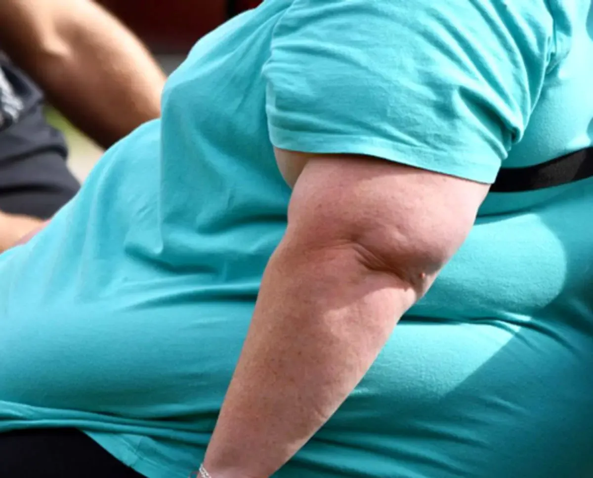 بیشتر از ۷۰ درصد افراد جامعه چاق  اند!