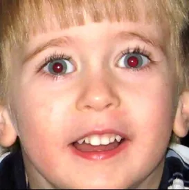 اگر چشم‌های‌تان در عکس‌ها قرمز می‌شود این خبر را بخوانید