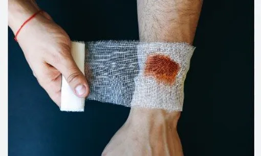 توصیه مهم اورژانسی در صورت بروز جراحت