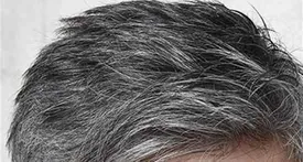 سیگاری ها موهایشان سفید می شود!